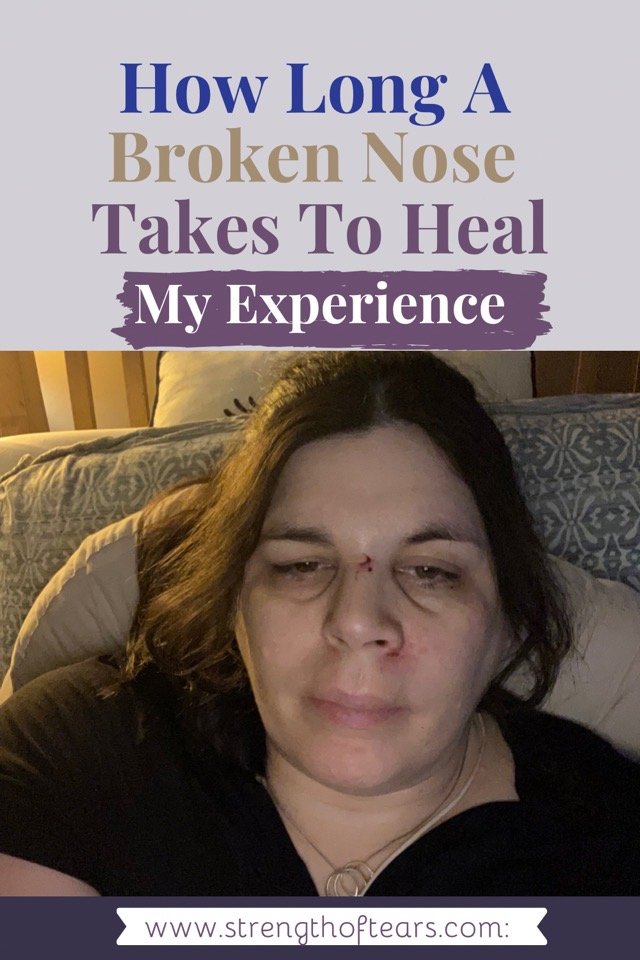 How Long a Broken Nose Takes To Heal - My Experience