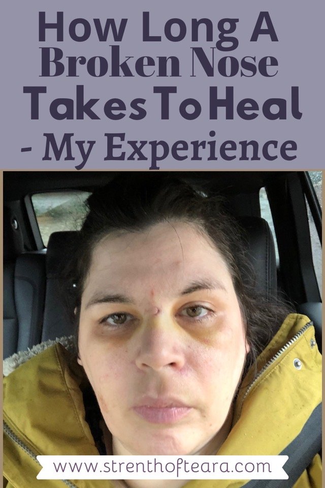 How Long a Broken Nose Takes To Heal - My Experience